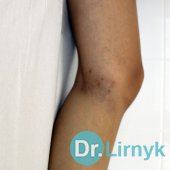 Короткий стриппінг